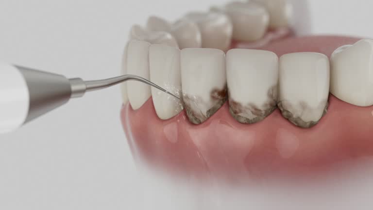 Trusted Wisdom Tooth Removal service in Lamar, SC - Dentist Open Now